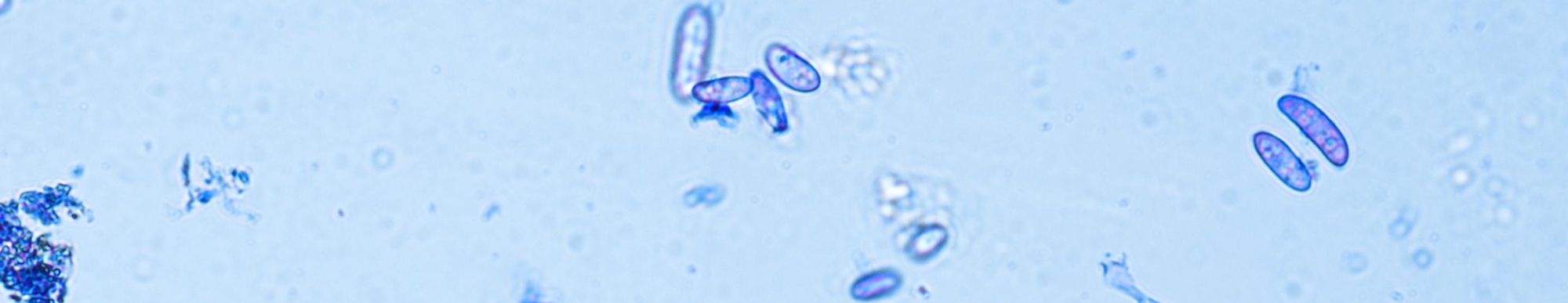 Soil,Microorganisms,Under,A,Microscope,Including,Amoeba,,Flagellates,,Nematodes,,Fungi,